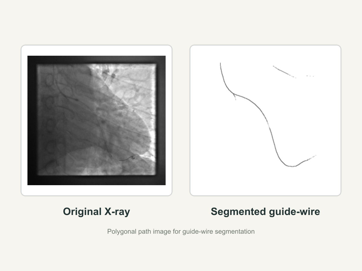 Original X-ray image and segmented guide-wire result from the polygonal path image work